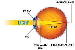 presbyopia- common eye conditions